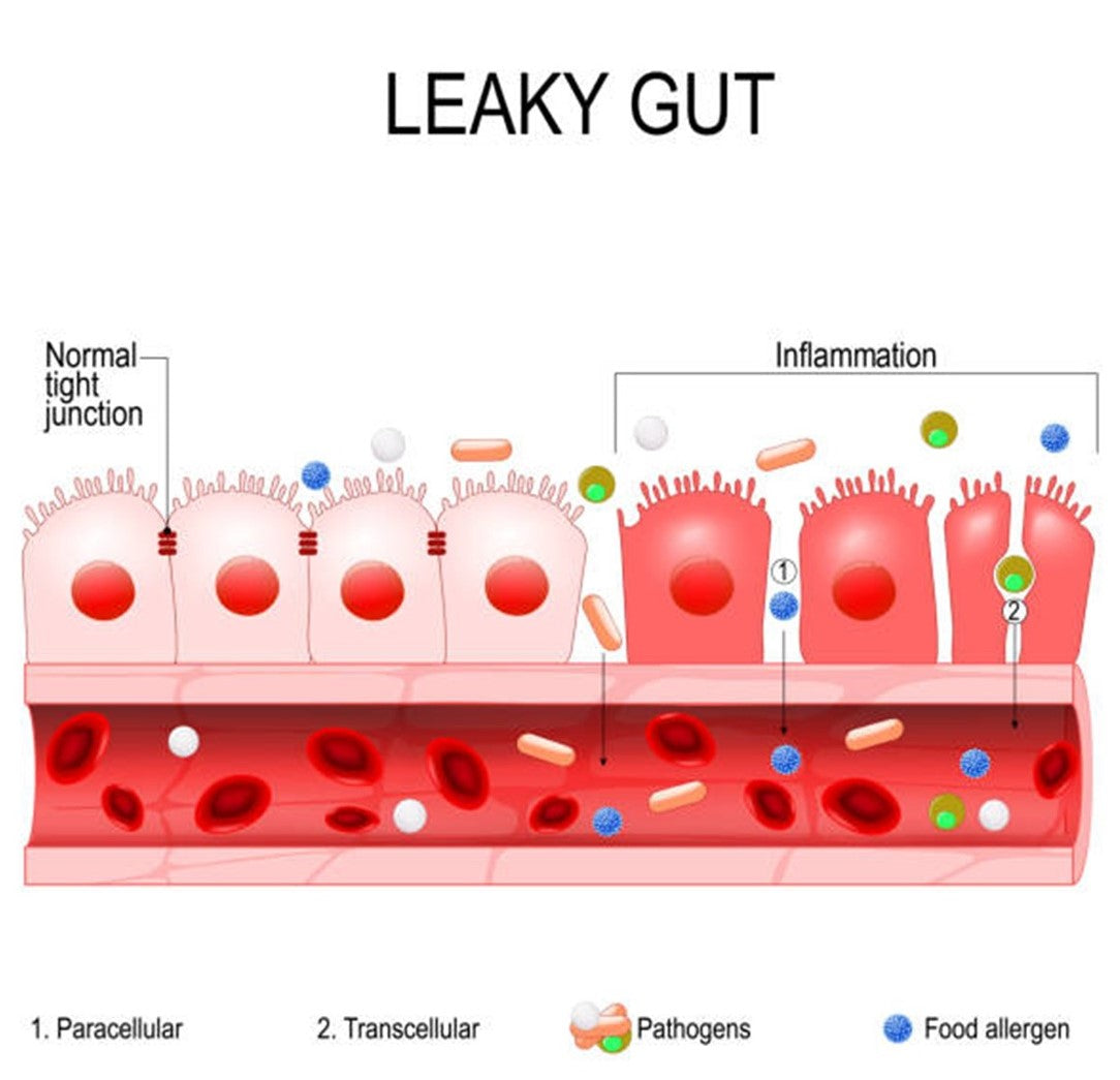 What is Leaky Gut?